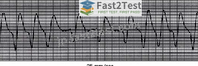 無料更新されたNBRC RPFTテストエンジン問題には117問あります [Q17-Q33] | Fast2test